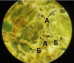В Куршском заливе выявлены опасные концентрации потенциально токсичных сине-зеленых водорослей
